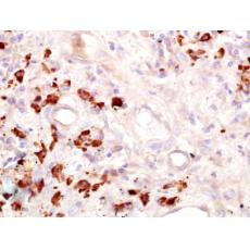 Anti-CD15 antibody