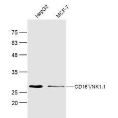 Anti-CD161/NK1.1 antibody