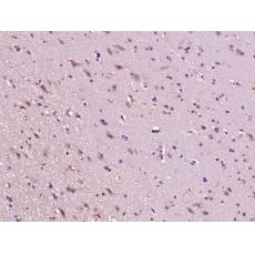 Anti-CD30 antibody