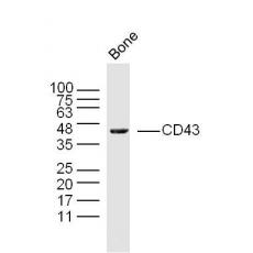 Anti-CD43 antibody
