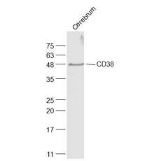 Anti-CD38 antibody
