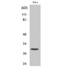 Anti-Ribosomal Protein S4X antibody