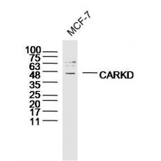 Anti-CARKD antibody