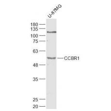 Anti-CCBR1 antibody