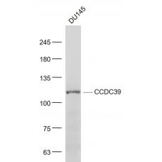 Anti-CCDC39 antibody