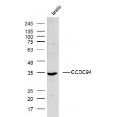 Anti-CCDC94 antibody