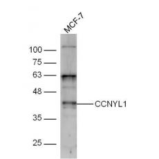 Anti-CCNYL1 antibody