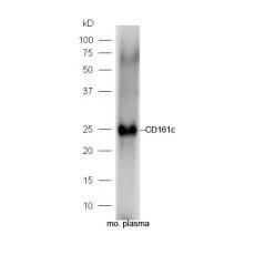 Anti-CD161c antibody