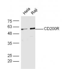 Anti-CD200R antibody