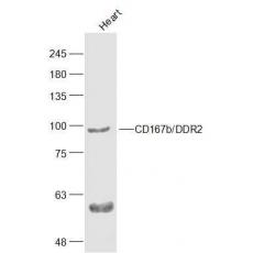 Anti-CD167b/DDR2 antibody