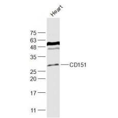 Anti-CD151 antibody