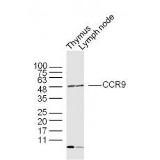 Anti-CCR9 antibody