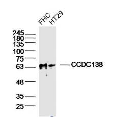 Anti-CCDC138 antibody