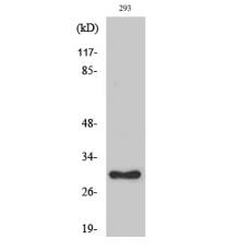 Anti-Ribosomal Protein L7 antibody