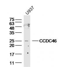 Anti-CCDC46 antibody