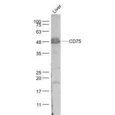 Anti-CD75 antibody