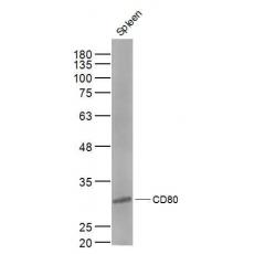 Anti-CD80 antibody
