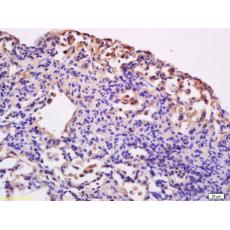 Anti-CD86 antibody