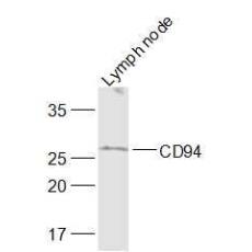 Anti-CD94 antibody
