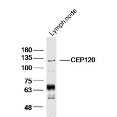 Anti-CEP120 antibody