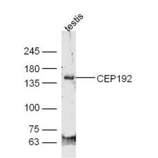 Anti-CEP192 antibody