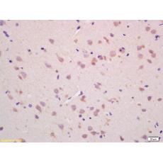Anti-CHAC1 antibody