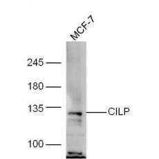 Anti-CILP antibody
