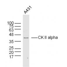 Anti-CK II alpha antibody