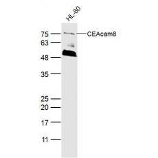 Anti-CEAcam8 antibody