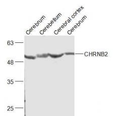 Anti-CHRNB2 antibody