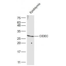 Anti-CIDEC antibody