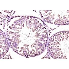 Anti-CITED1 antibody