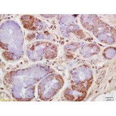 Anti-CKMT antibody