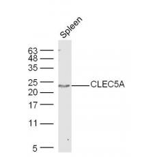 Anti-CLEC5A antibody