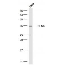 Anti-CLN8 antibody