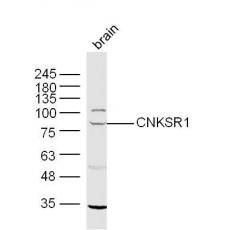 Anti-CNKSR1 antibody