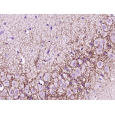 Anti-CNR1 antibody