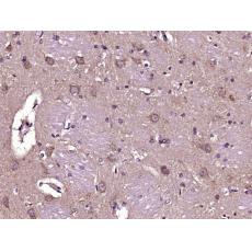 Anti-COG1 antibody