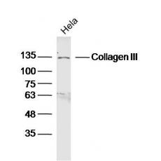 Anti-Collagen III antibody