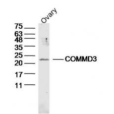 Anti-COMMD3 antibody