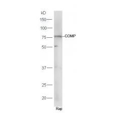 Anti-COMP antibody