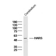 Anti-HARS antibody