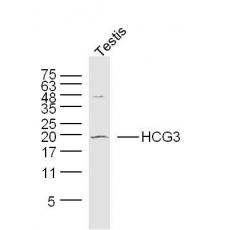 Anti-HCG3 antibody