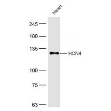 Anti-HCN4 antibody