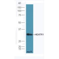 Anti-HEATR1 antibody