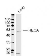 Anti-HECA antibody