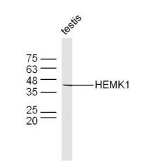Anti-HEMK1 antibody