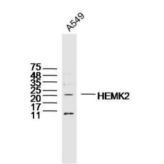 Anti-HEMK2 antibody