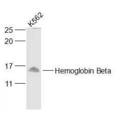 Anti-Hemoglobin Beta antibody