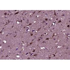 Anti-HEPACAM antibody